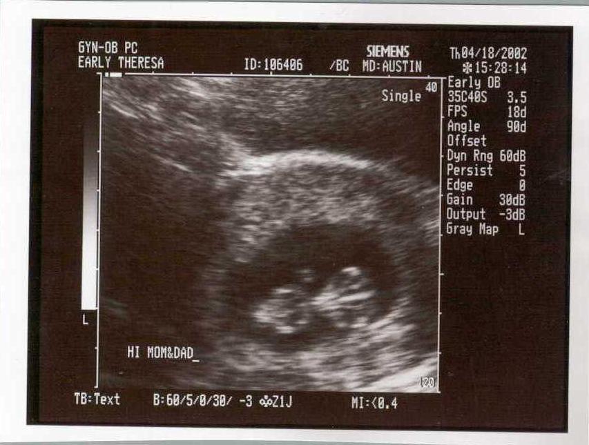 baby3.JPG